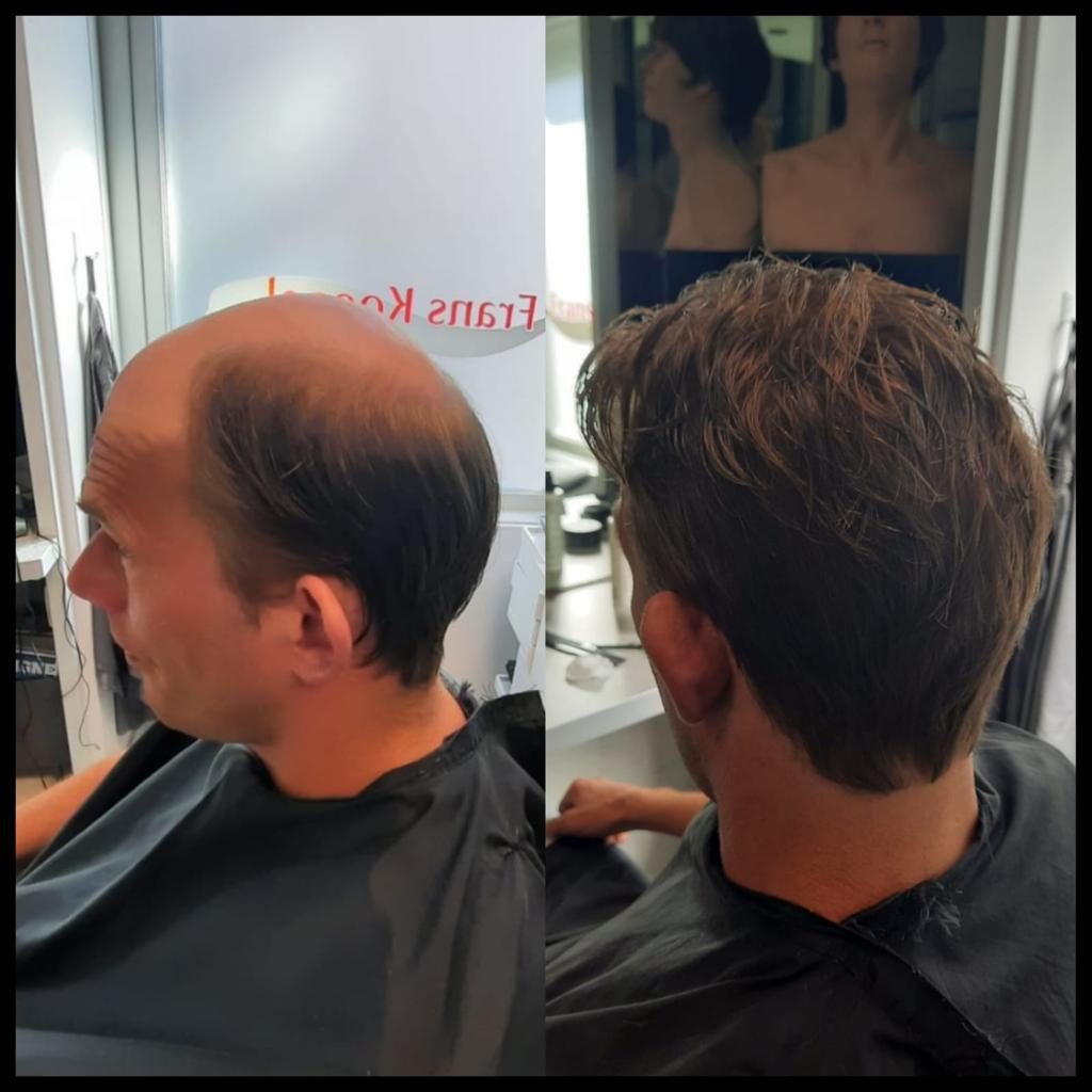 Previs site Vergelijkbaar Trein Haarwerken mannen - Frans Koopal Haarwerken - Secret Hair